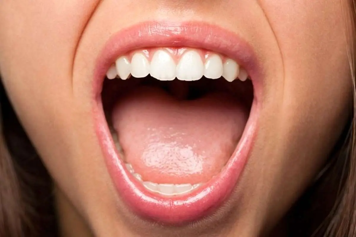 (عکس) چه چیزی باعث ایجاد خط سفید داخل گونه‌ها می‌شود؟