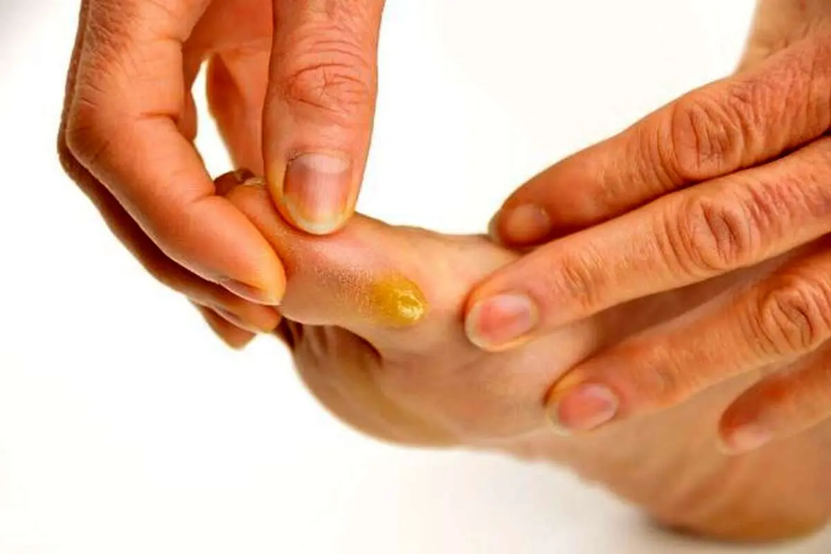 آن چه پا‌هایتان در مورد سلامتی و خطر قاتلان خاموش لو می‌دهد!