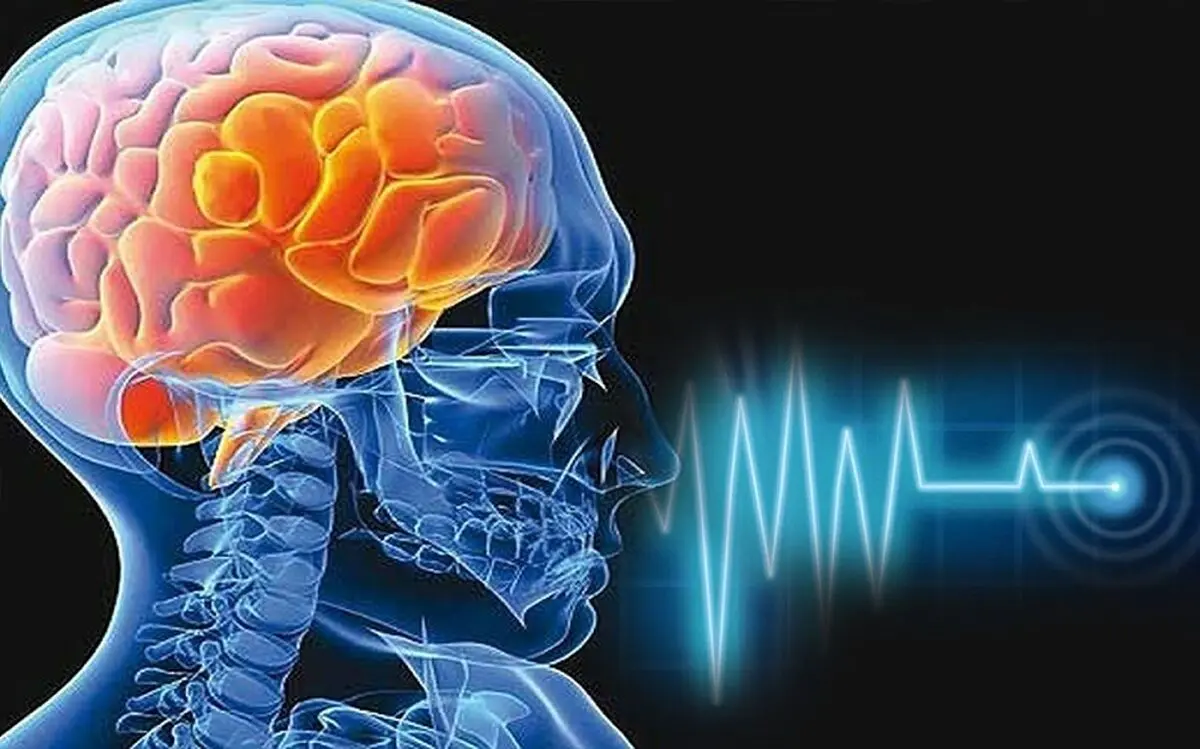 (اینفوگرافیک) دلایل سکته مغزی