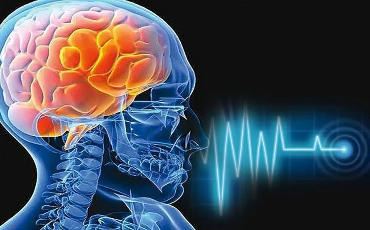 (اینفوگرافیک) دلایل سکته مغزی