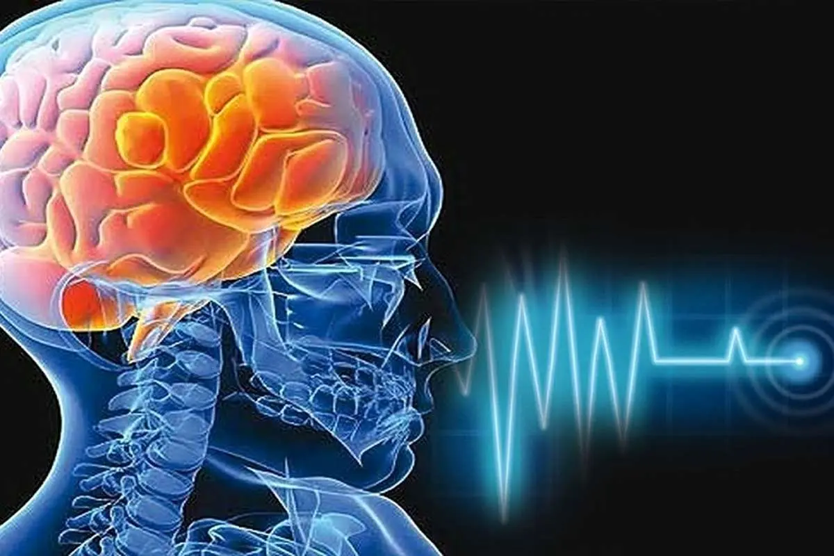 (اینفوگرافیک) دلایل سکته مغزی