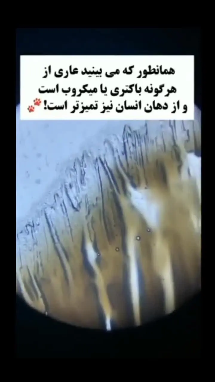 (ویدئو) آب دهان گربه زیر میکروسکوپ