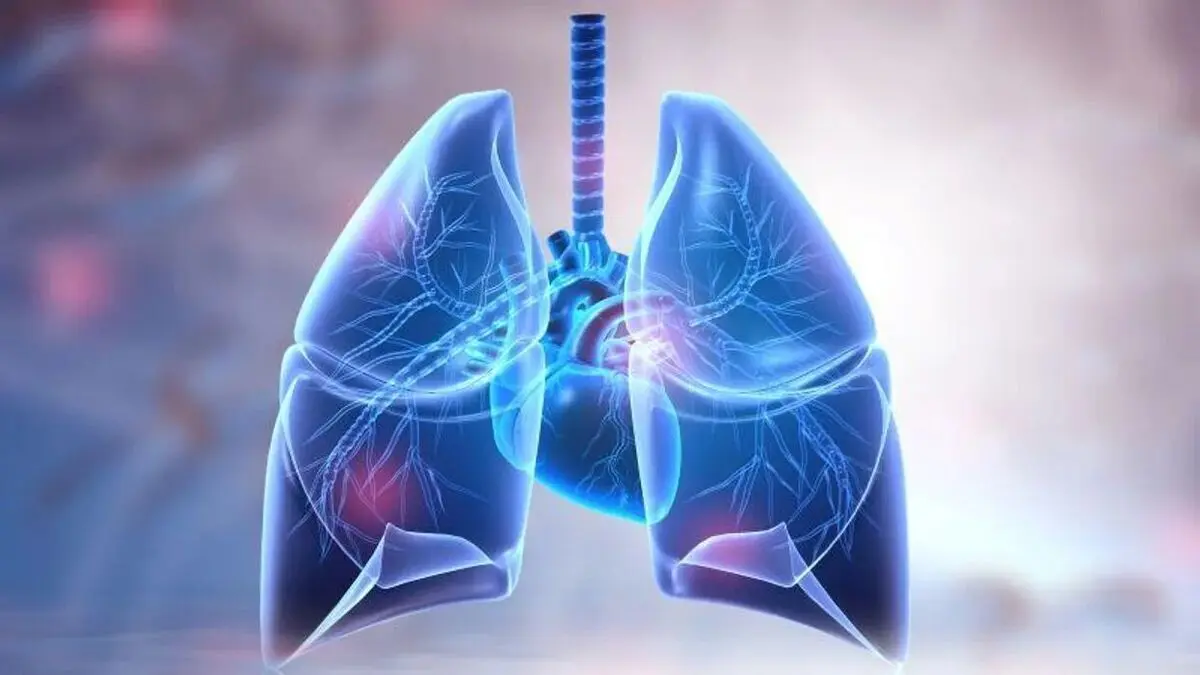 چند توصیه برای پیشگیری از سرطان ریه