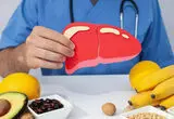راهکارهایی ساده برای پیشگیری از بیماری کبد چرب