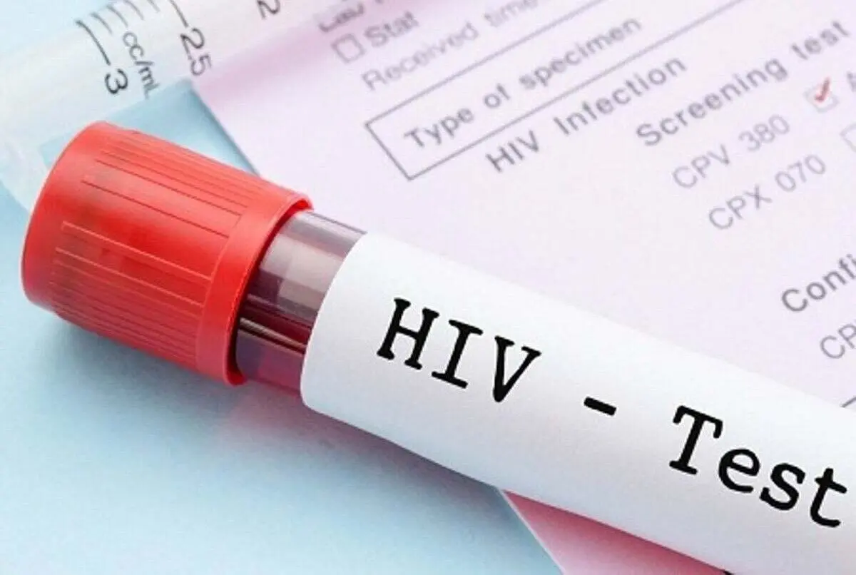 کاهش سهم «اعتیاد» در انتقال HIV؛ توضیح وزارت بهداشت درباره تغییر الگوی انتقال بیماری