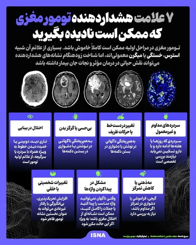 این نشانه‌ها را جدی بگیرید / 7 علامت هشداردهنده تومور مغزی 2