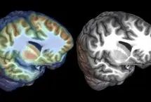 هوش مصنوعی به کمک کودکان مبتلا به صرع می‌آید