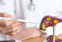 ۶ مکمل‌ و ویتامین برای کنترل بیماری کبد چرب و آنزیم‌های کبدی