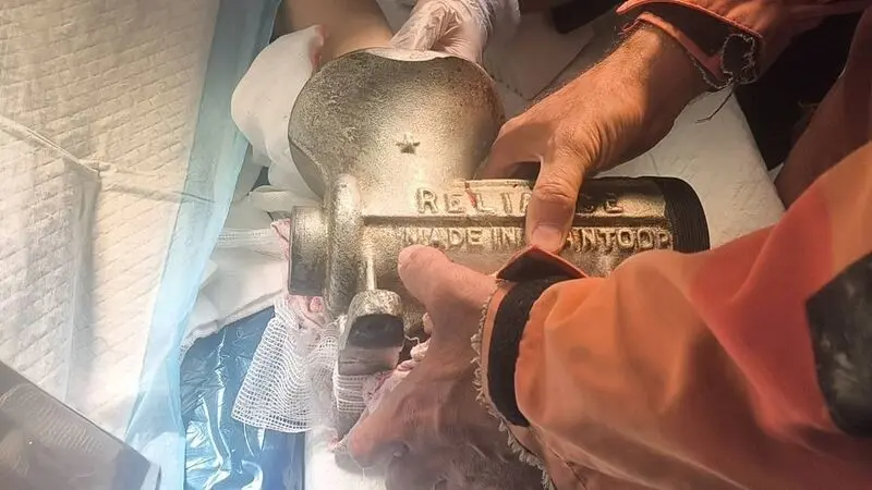 جراحت دست در چرخ گوشت