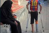 تصاویر؛ لوله پلاستیکی جای پای قطع شده کودک فلسطینی را گرفت