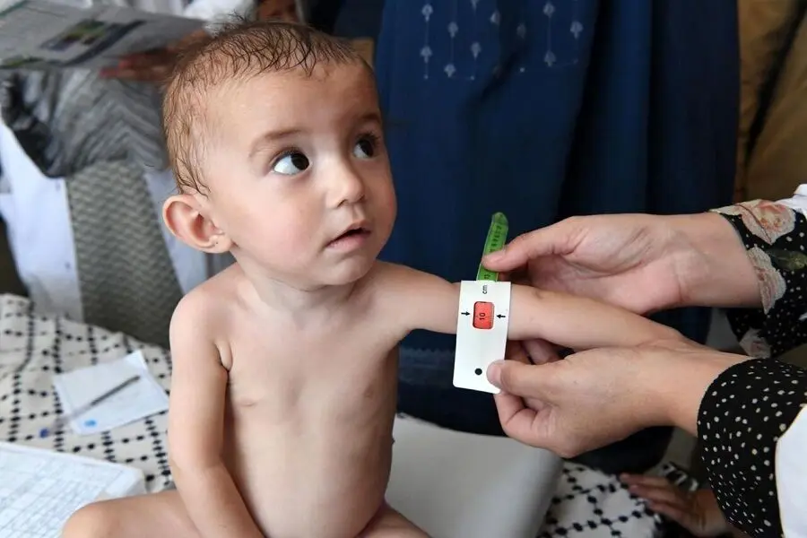 همه چیز درباره یارانه کودکان دارای سوء تغذیه ‌