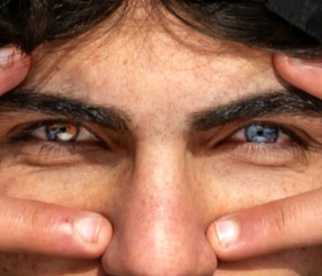 چشم‌های متفا‌وت جوان کُرد