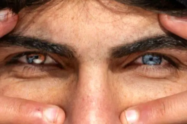 چشم‌های متفا‌وت جوان کُرد