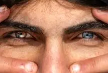 چشم‌های متفا‌وت جوان کُرد