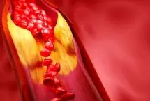 آیا باید از کلسترول و تری‌گلیسیرید بالا ترسید؟