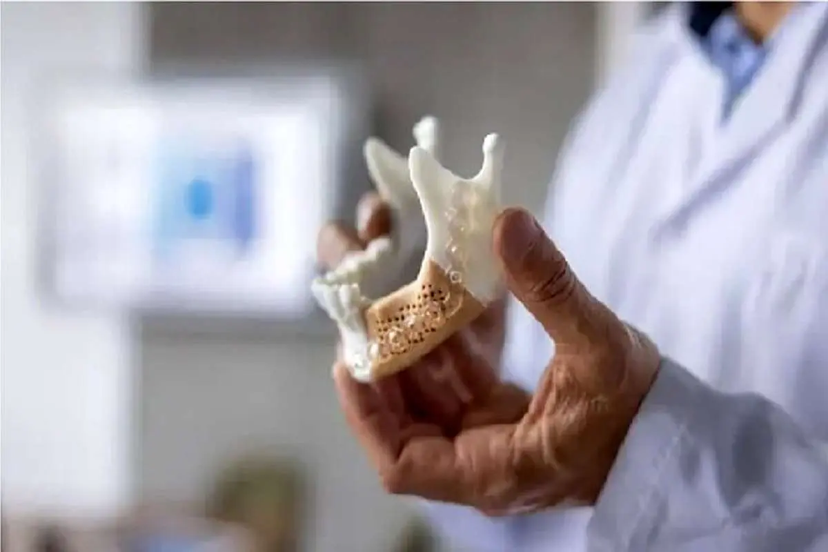 ایمپلنتهای آینده از شیشه ساخته میشوند!