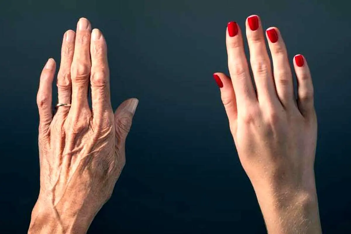 بهترین روشها برای مقابله و جلوگیری از چروک شدن پوست دستان