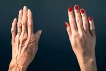 بهترین روش‌ها برای مقابله و جلوگیری از چروک شدن پوست دستان
