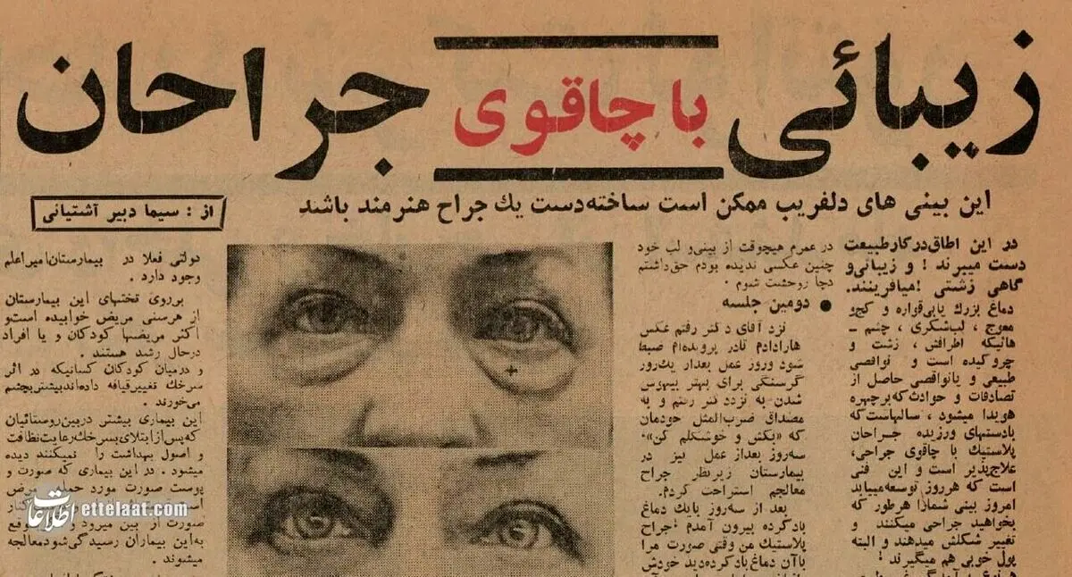 (عکس) ۶۰ سال پیش؛ اولین جراحی‌های زیبایی در تهران اینجا انجام شد