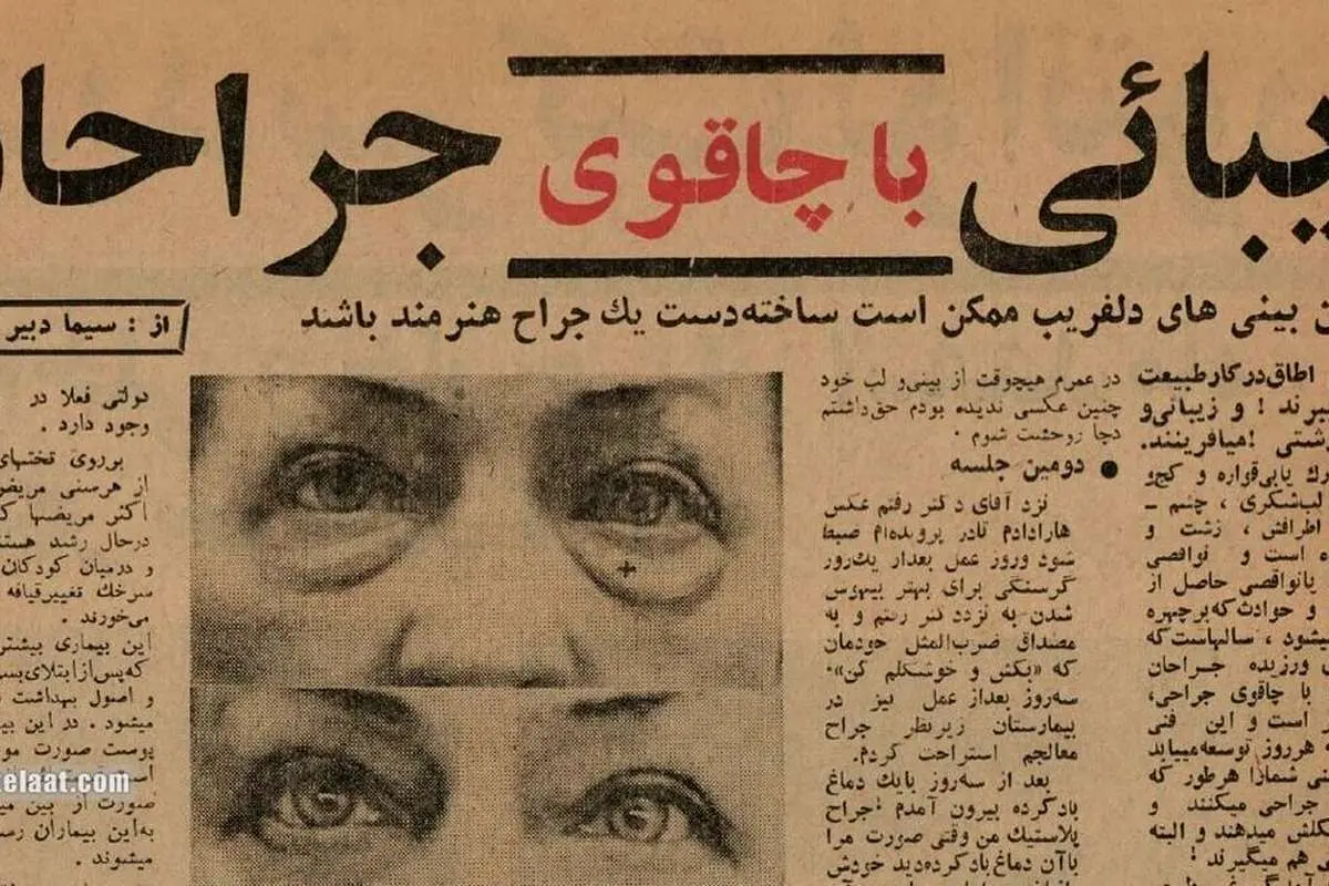 (عکس) ۶۰ سال پیش؛ اولین جراحی‌های زیبایی در تهران اینجا انجام شد