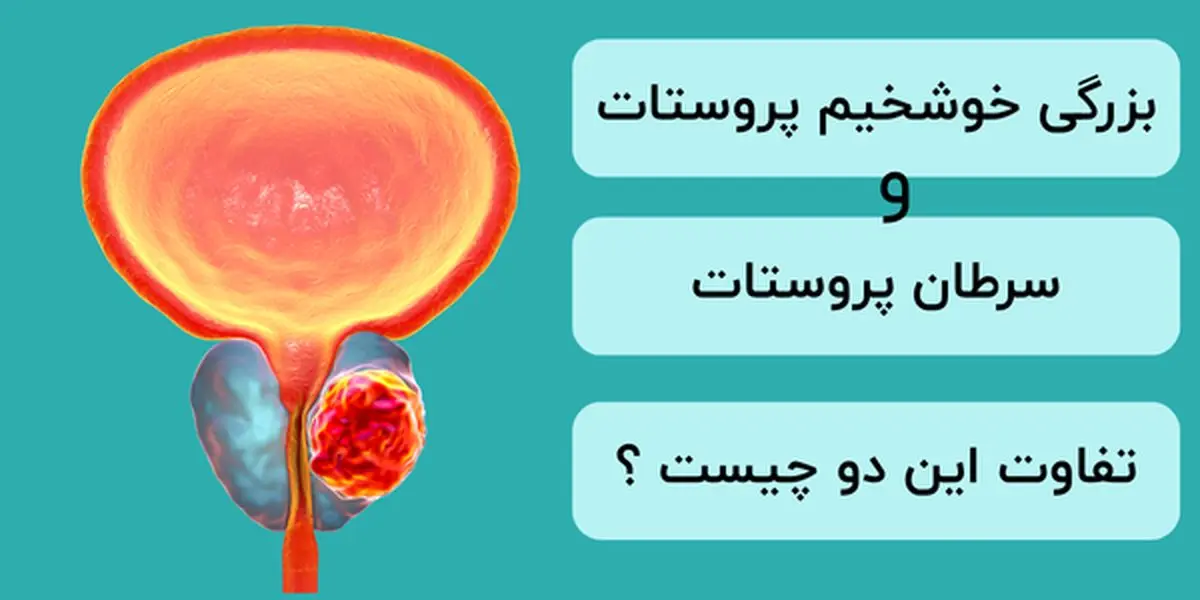 آیا بزرگ شدن پروستات نشانه سرطان است ؟