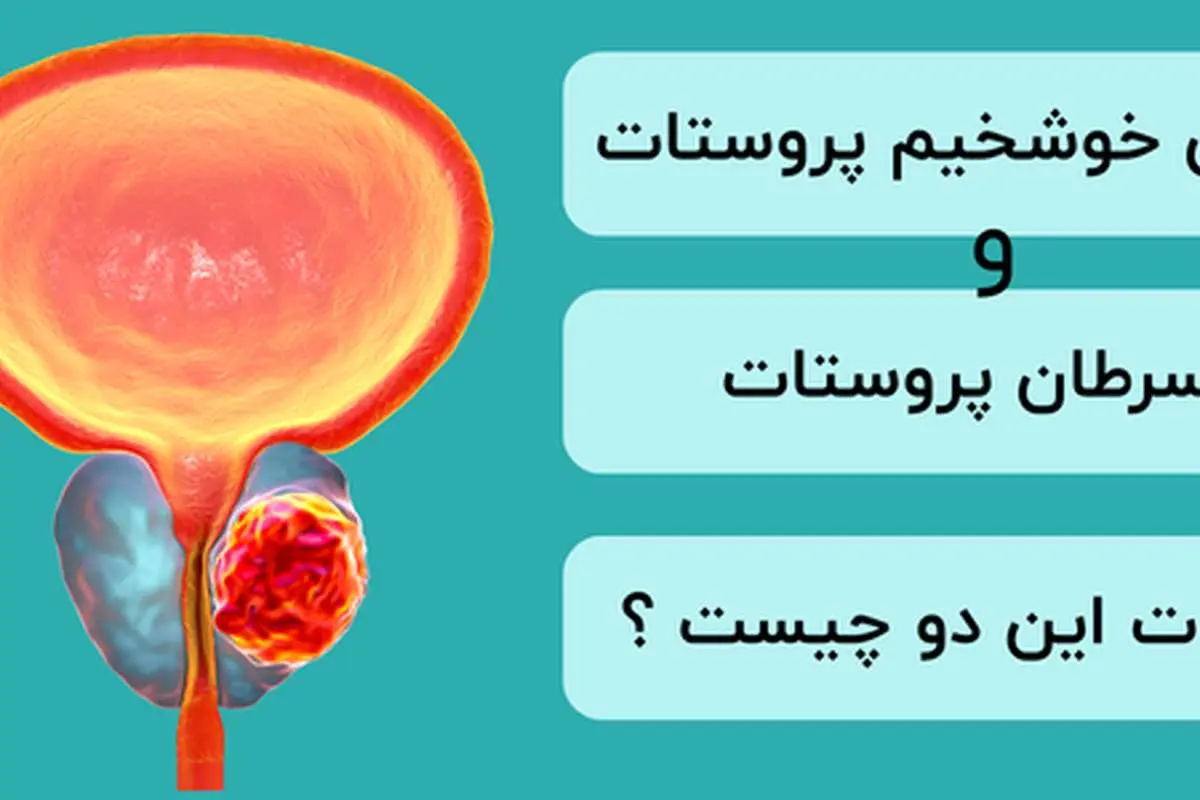 آیا بزرگ شدن پروستات نشانه سرطان است ؟