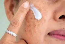 لکه‌های پوستی بارداری؛ چرا ایجاد می‌شوند و چگونه از آن‌ها پیشگیری کنیم؟