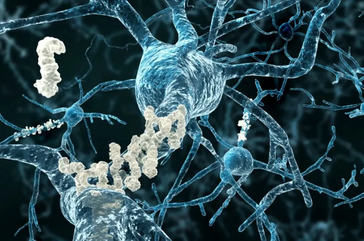 یک آزمایش ساده برای پیش بینی آلزایمر