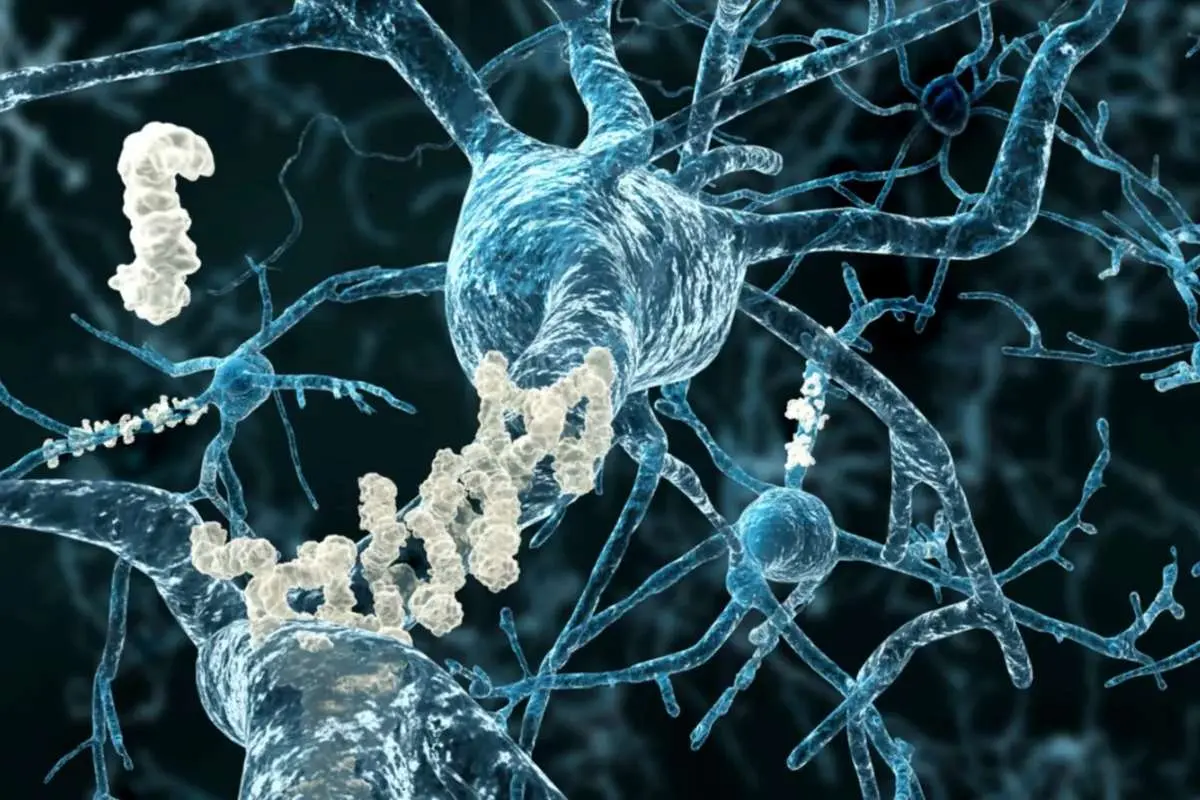 یک آزمایش ساده برای پیش بینی آلزایمر