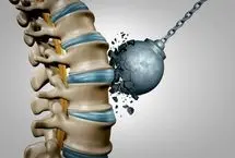 (ویدئو) استخوان این زنان بیشتر از بقیه پوک می‌شود