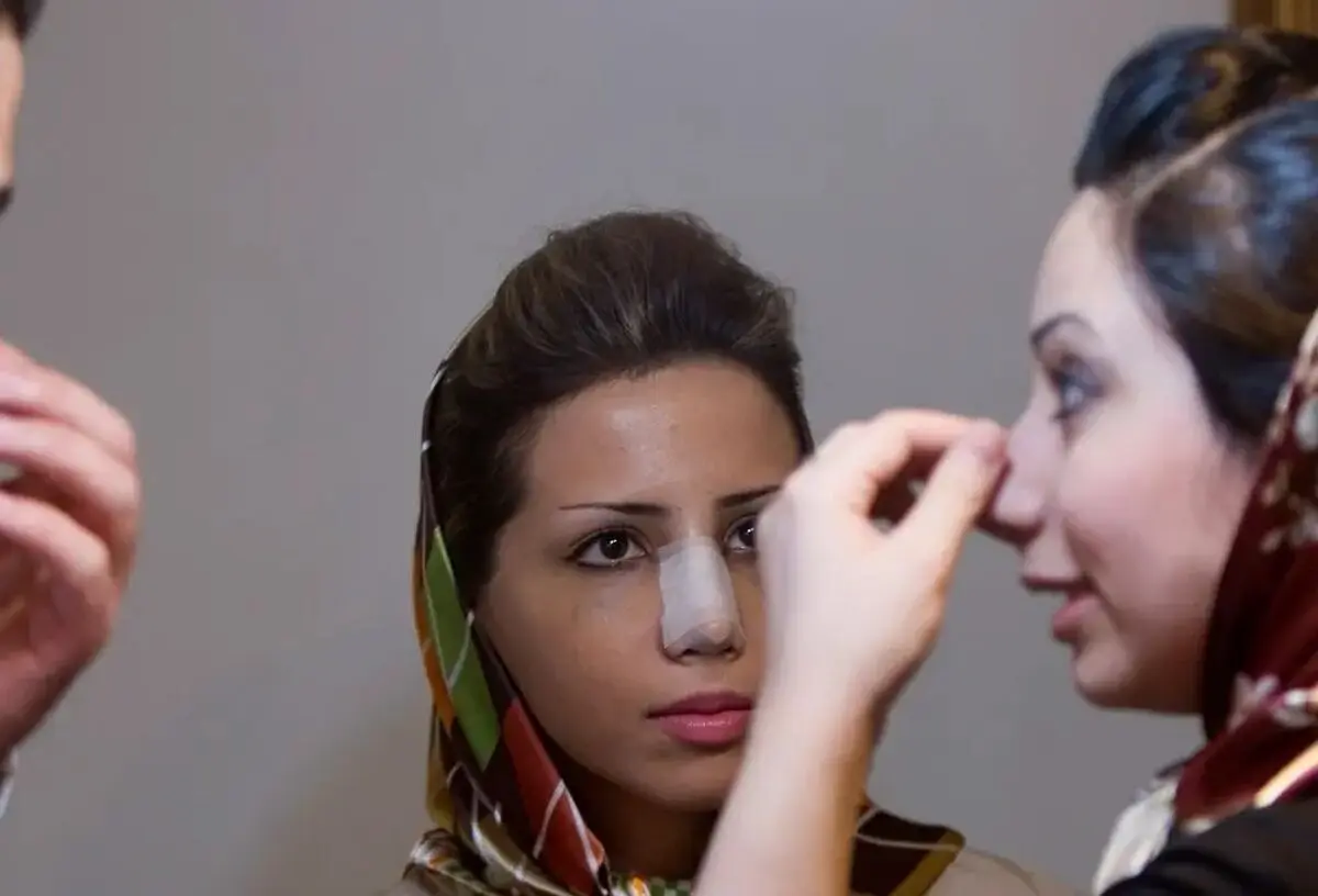 عکس؛ گزارش خبرگزاری فرانسه از عمل زیبایی بینی در ایران