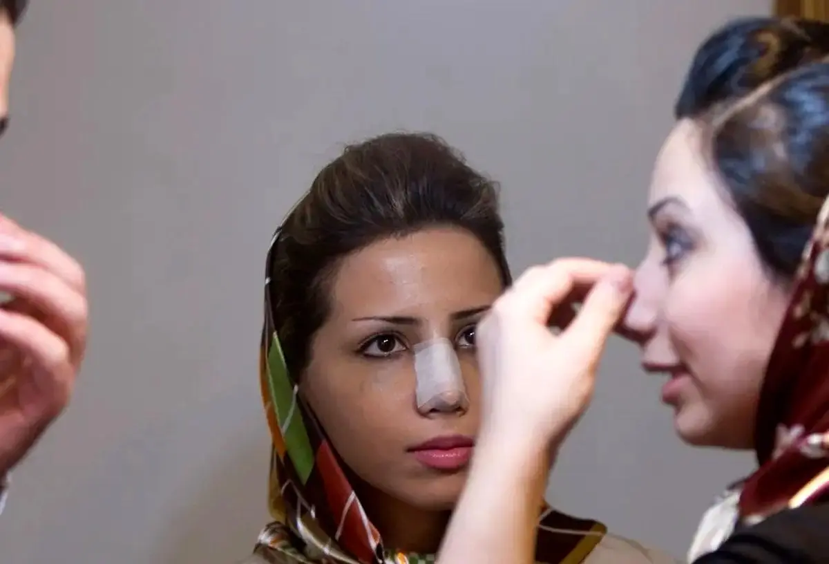 عکس؛ گزارش خبرگزاری فرانسه از عمل زیبایی بینی در ایران