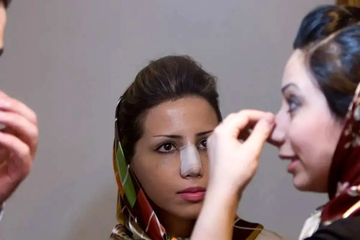 عکس؛ گزارش خبرگزاری فرانسه از عمل زیبایی بینی در ایران