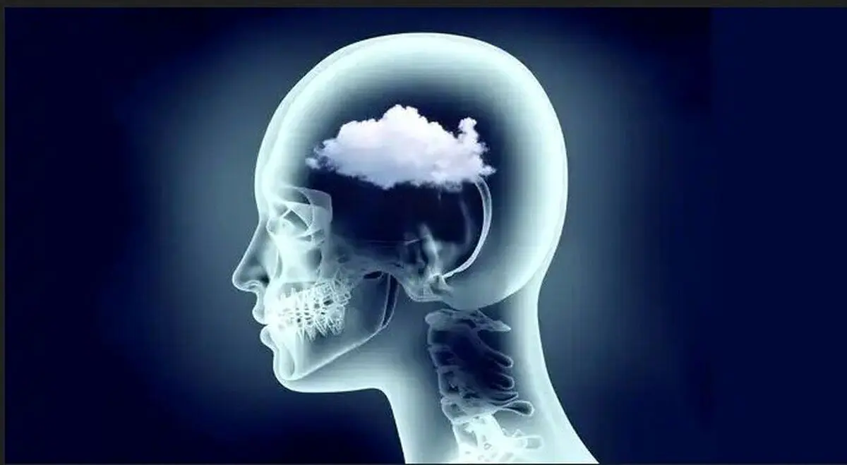 مه مغزی چیست و چه نشانه‌هایی دارد؟