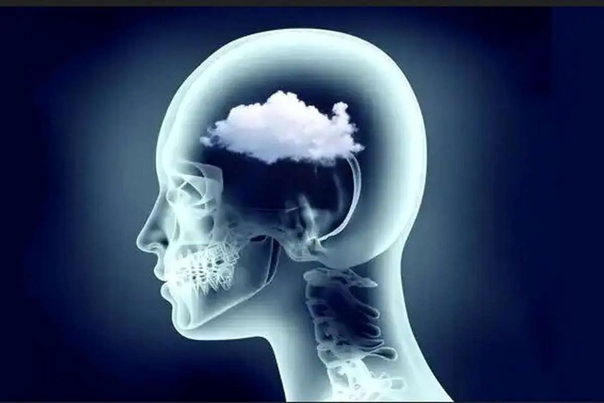 مه مغزی چیست و چه نشانه‌هایی دارد؟