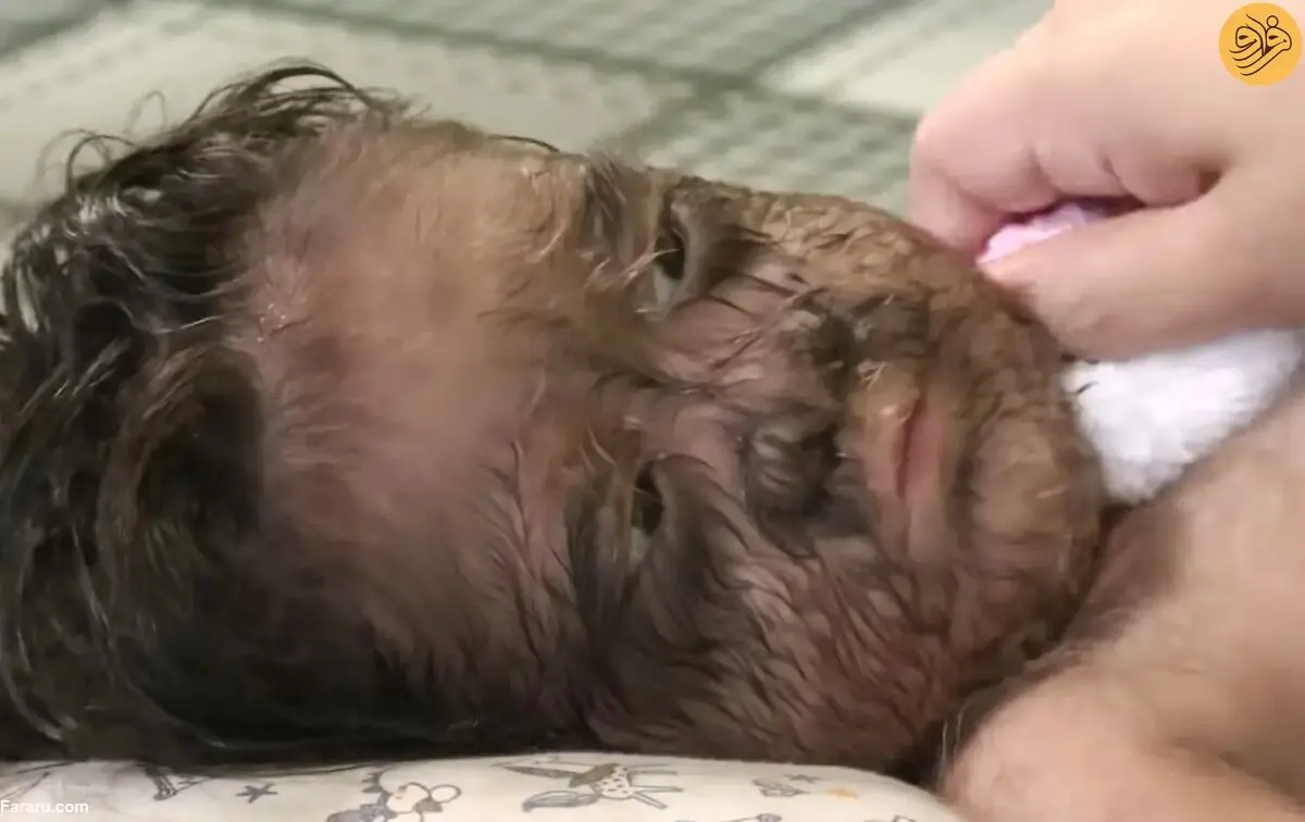 (تصاویر) دختر دو ساله با صورت پر از مو؛ دختری از بهشت یا کودک حیوانی!