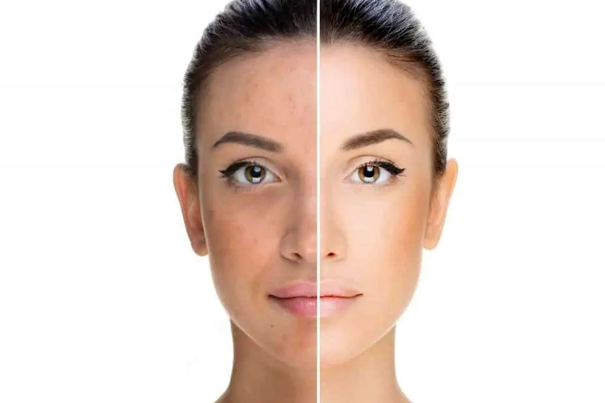 جنجال در تیک تاک؛ آیا مصرف روزانه هویج واقعا رنگ پوست را برنزه میکند؟