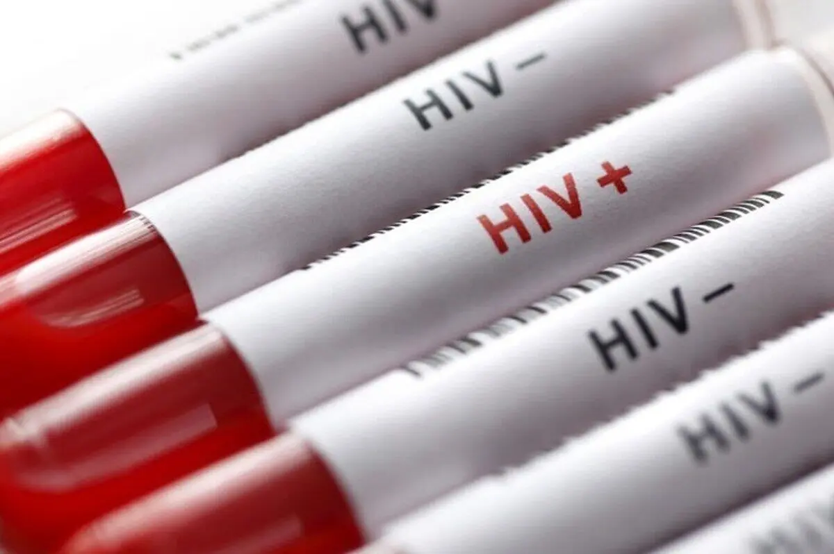 چند نفر در ایران مبتلا به HIV هستند؟