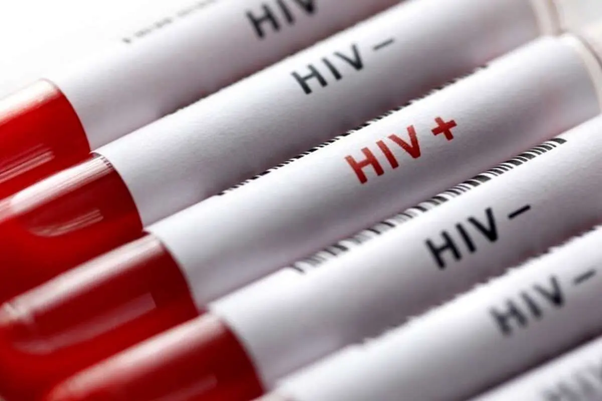 چند نفر در ایران مبتلا به HIV هستند؟