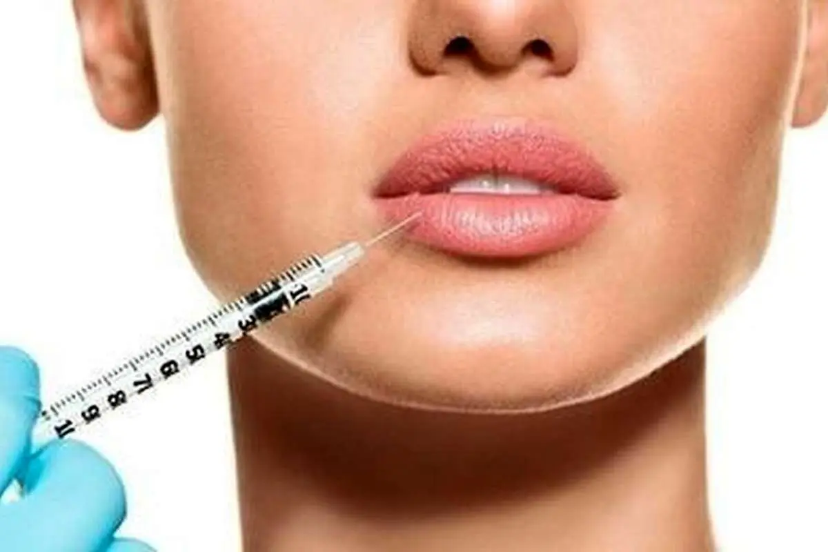 آیا بوتاکس و فیلر نگاه ما را به زیبایی تغییر می‌دهند؟