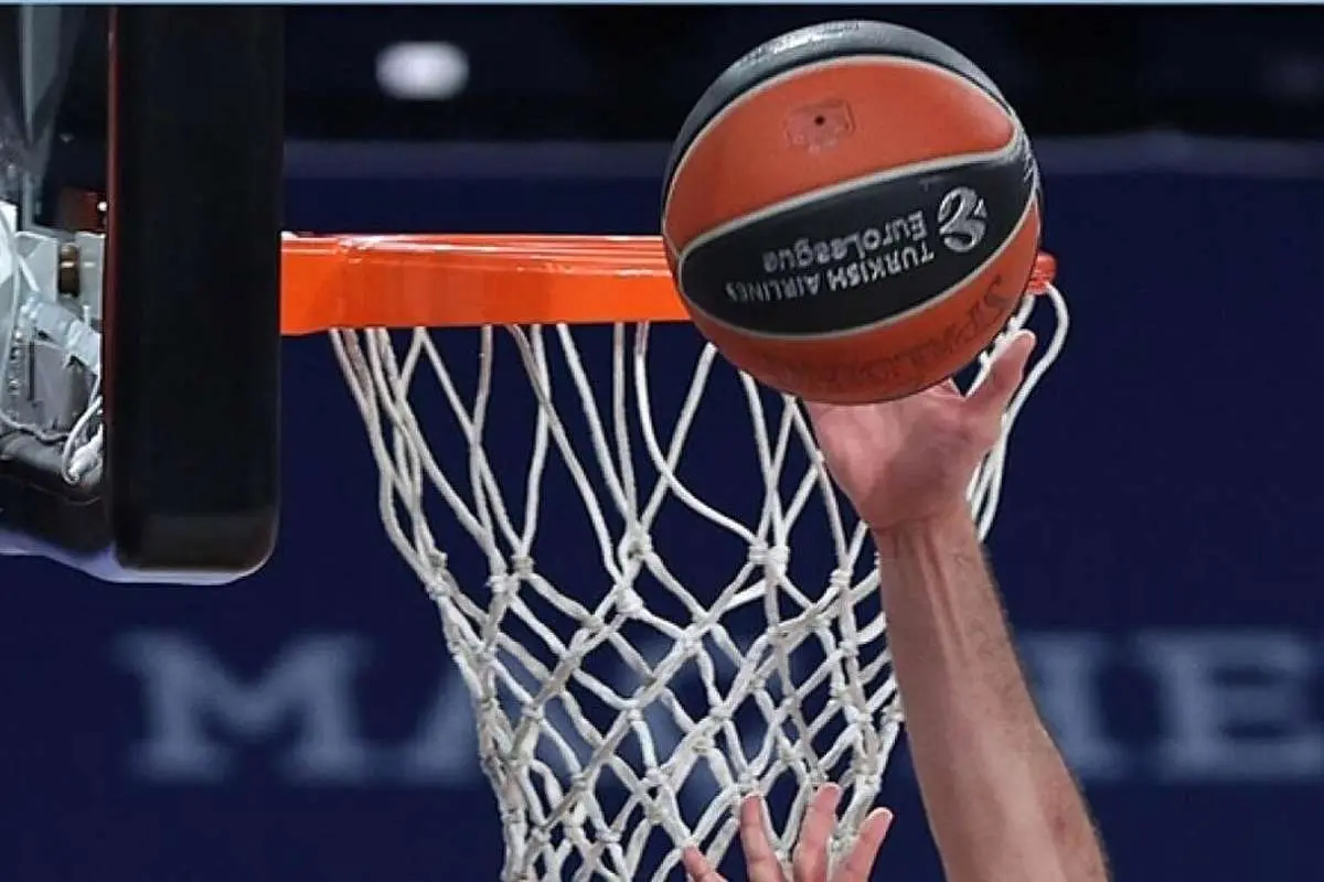 (تصویر) مدل موی عجیب بازیکن سن آنتونیو آمریکا در مسابقات پیشفصل NBA