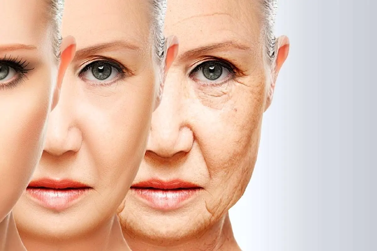 راهکارهای جلوگیری از شل شدن پوست