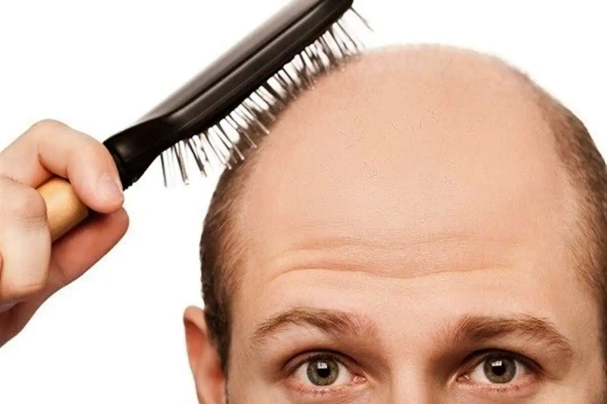 به خاطر نگرانی از ریزش مو، موهای خود را از دست ندهید!