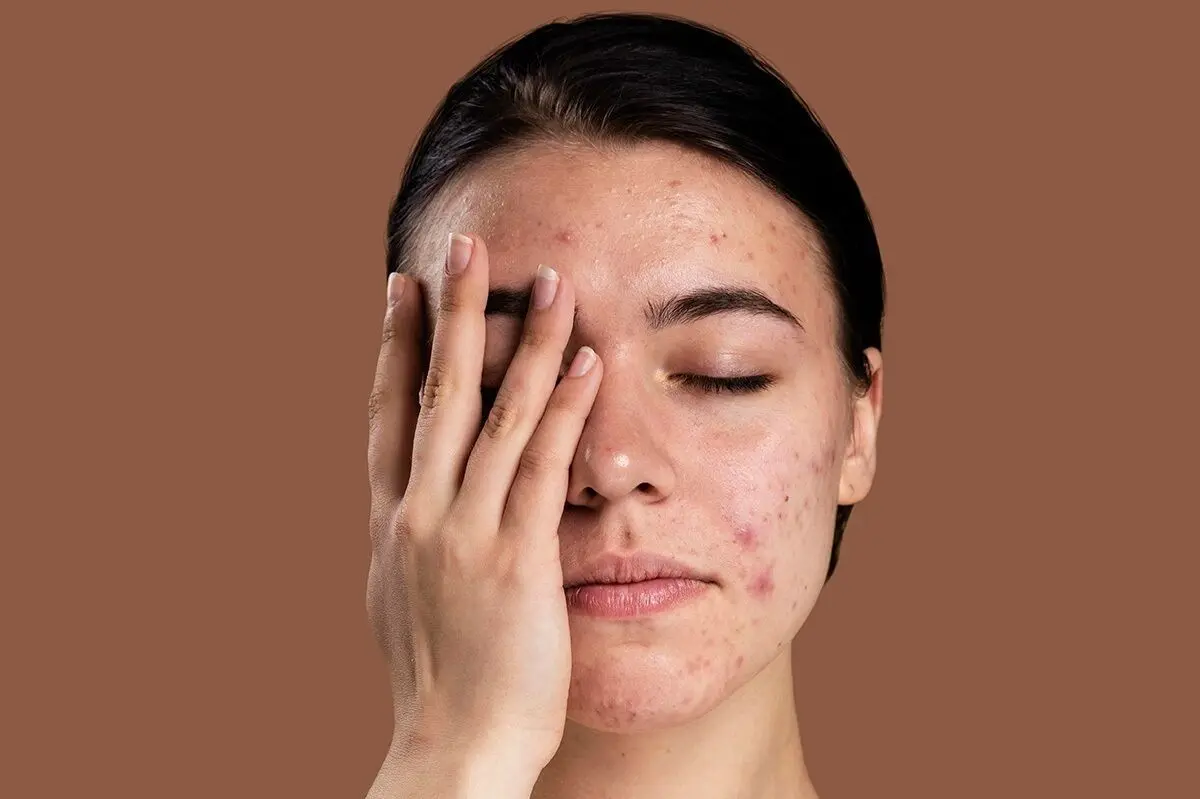 مشکلات پوستی ناشی از ورزش کردن در فضای باز