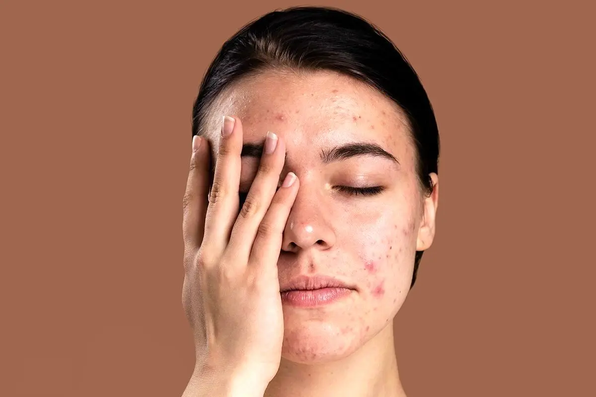 مشکلات پوستی ناشی از ورزش کردن در فضای باز