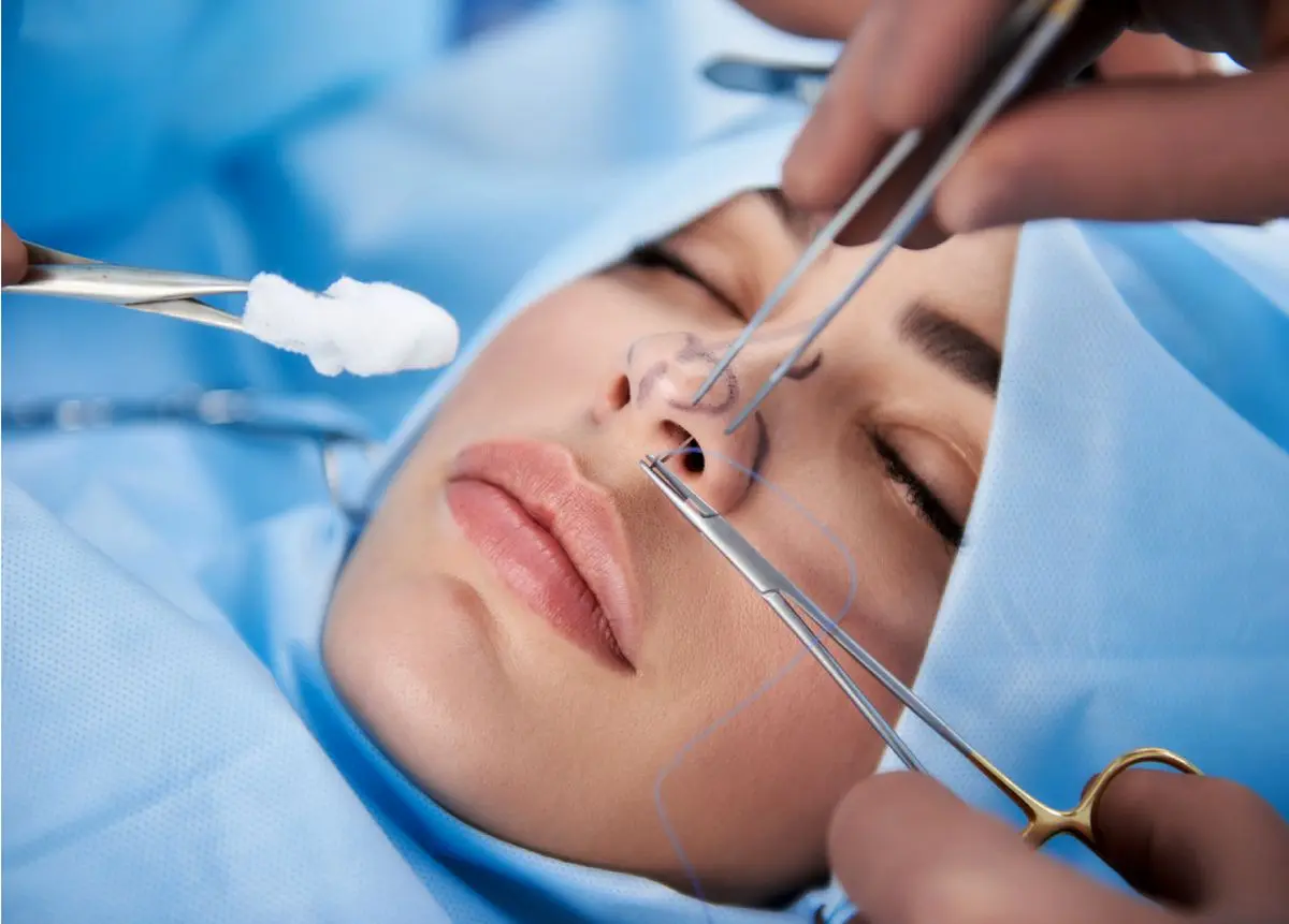(ویدئو) آیا جراحی زیبایی بینی برای مبتلایان به دیابت خطرناک است؟