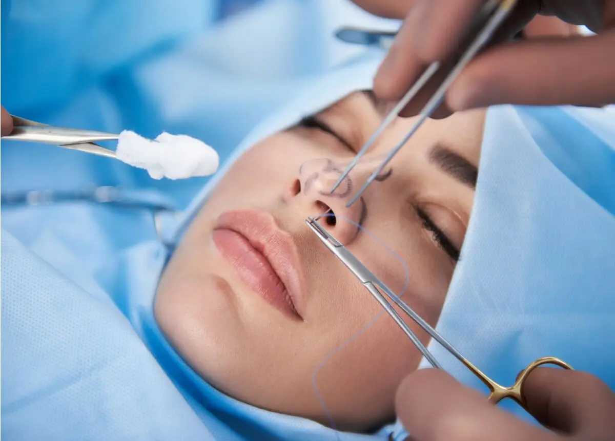 (ویدئو) آیا جراحی زیبایی بینی برای مبتلایان به دیابت خطرناک است؟