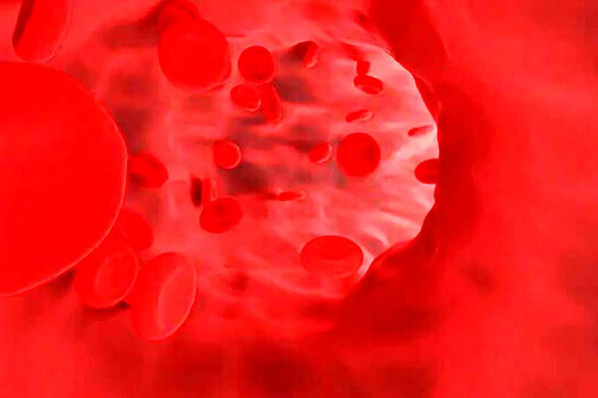 ۱۳ راهکار خانگی و ساده برای کاهش فشارخون