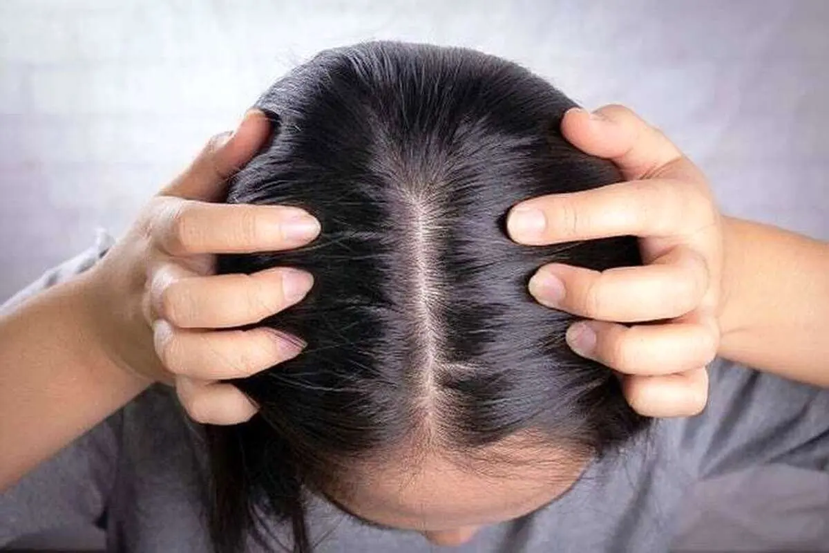 چرا موهایمان زود چرب میشود؟