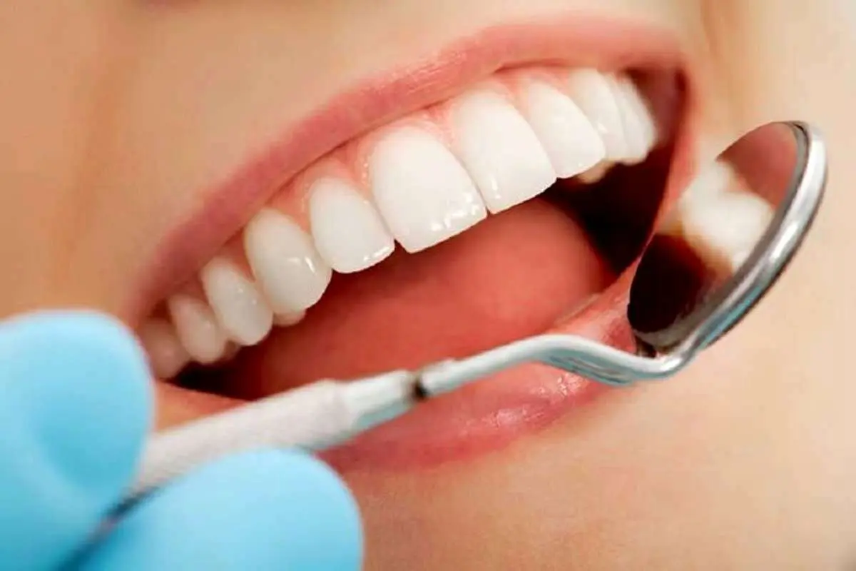 کدام مواد غذایی از پوسیدگی دندانها پیشگیری میکنند؟
